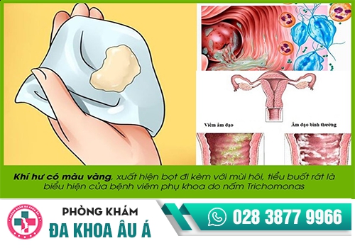 KHÍ HƯ CÓ MÀU VÀNG 